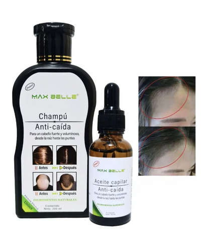 PACK ANTICAIDA MAX BELLEZA